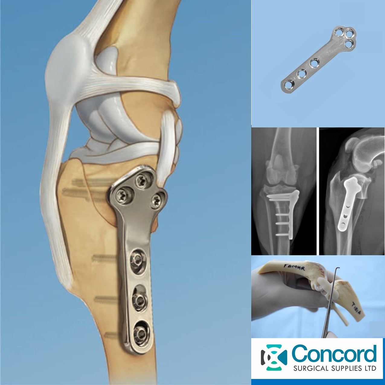 ORTHOPAEDIC<br> IMPLANTS